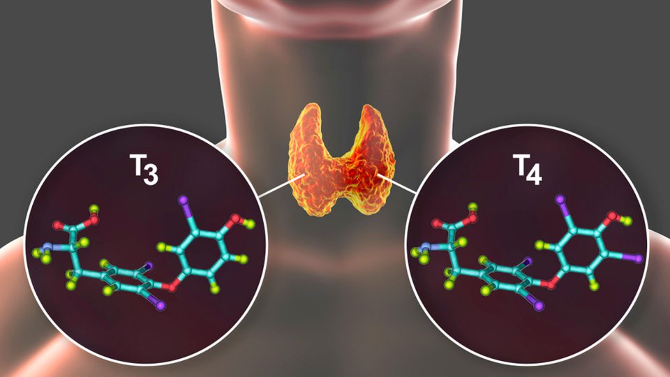 Serbest T3 ve Serbest T4 Nedir? T3-T4 Yüksekliği ve Düşüklüğü