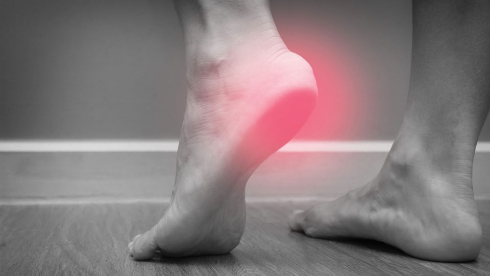 Topuk Dikeni: Belirtileri, Nedenleri ve Tedavisi