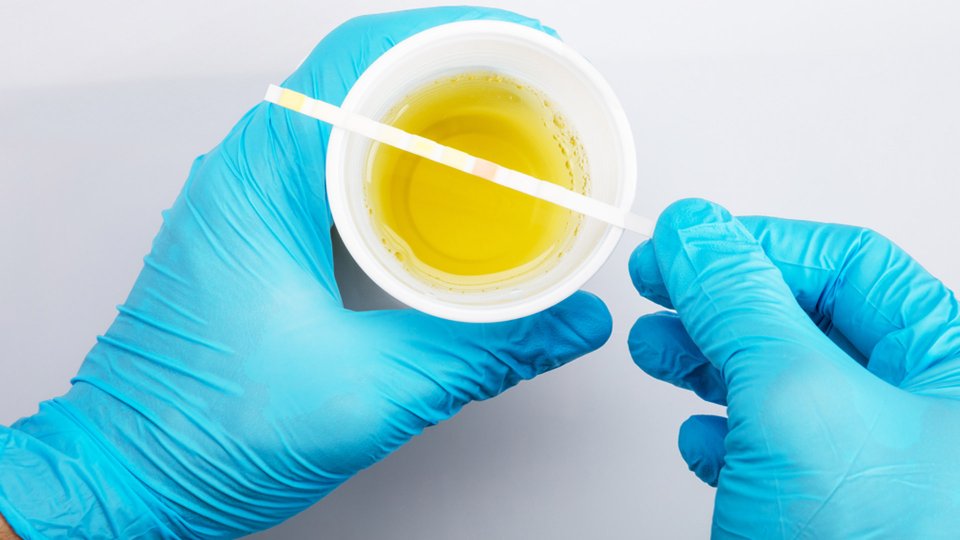 Üre Nedir? Üre Düşüklüğü ve Yüksekliği Ne Anlama Gelir?