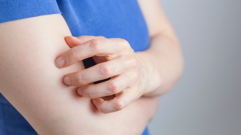 Uyuz Belirtileri Nelerdir? Uyuz Hastalığı Bulaşıcı mı?