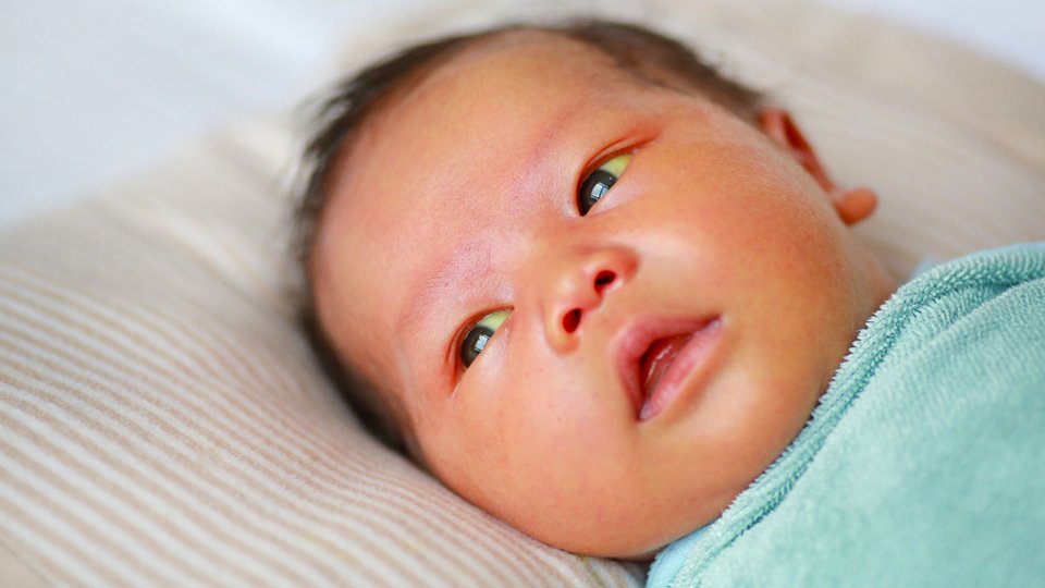 Uzamış Sarılık Nedenleri Nelerdir? Uzayan Sarılık İçin Ne Yapılmalı?