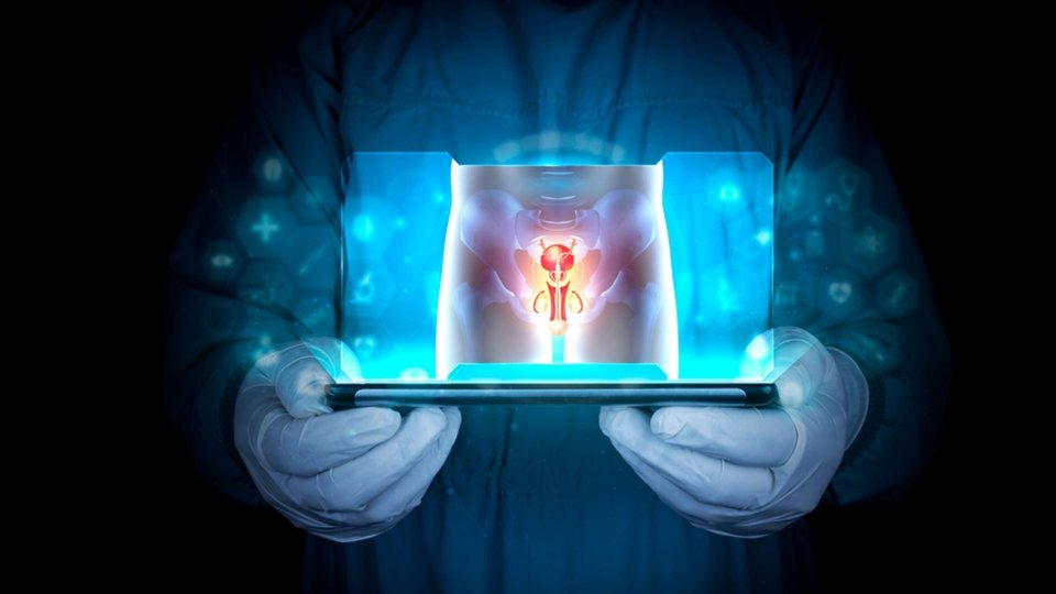 Varikosel Hastalığı ve Mikrocerrahi Varikoselektomi