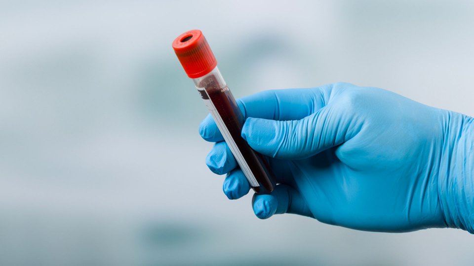 Wilson Hastalığı Nedir? Nasıl Tedavi Edilir?