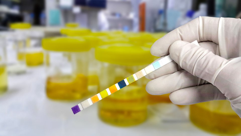 İdrar Yolu Enfeksiyonu Belirtileri Nelerdir? Ne İyi Gelir?