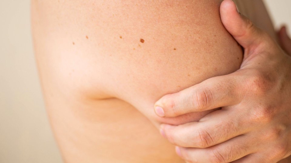 Yumuşak Doku Kanseri Nedir? Belirtileri ve Tedavisi