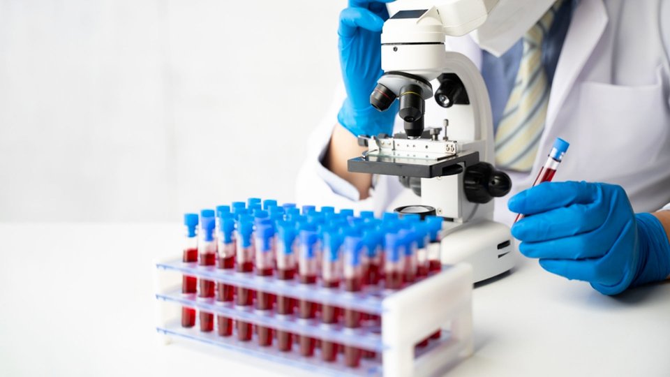 aPTT Nedir? aPTT Yüksekliği ve Düşüklüğü