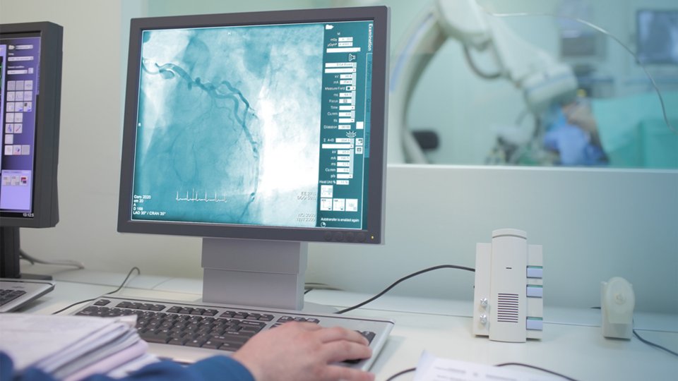 Anjiyo Nedir? Nasıl Yapılır?