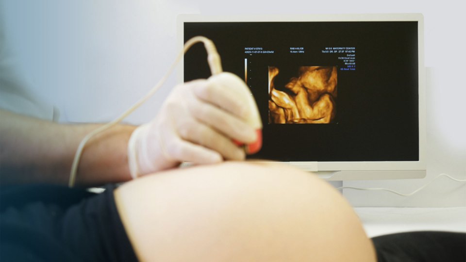 Ayrıntılı Ultrason Nedir? Hangi Hastalıklarda Kullanılır?