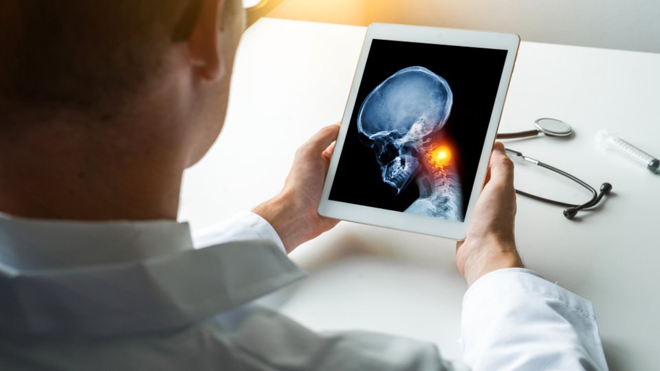 Baş Boyun Kanseri Nedir?