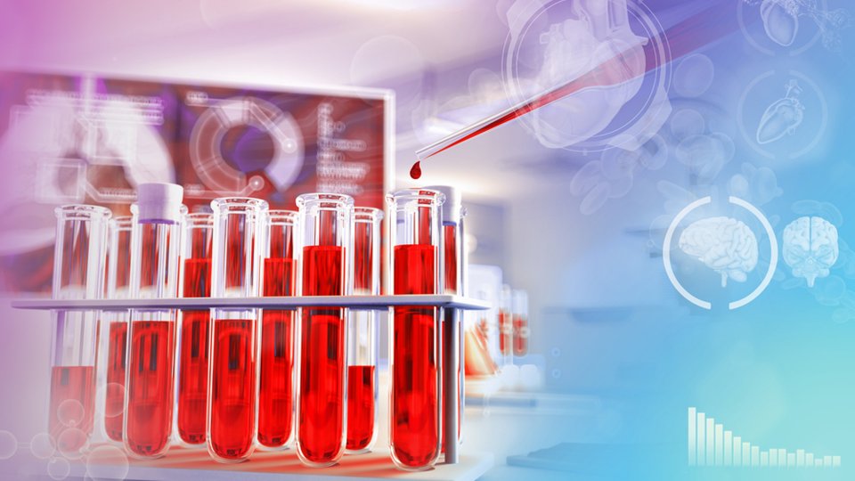 Bilirubin Testi Nedir?