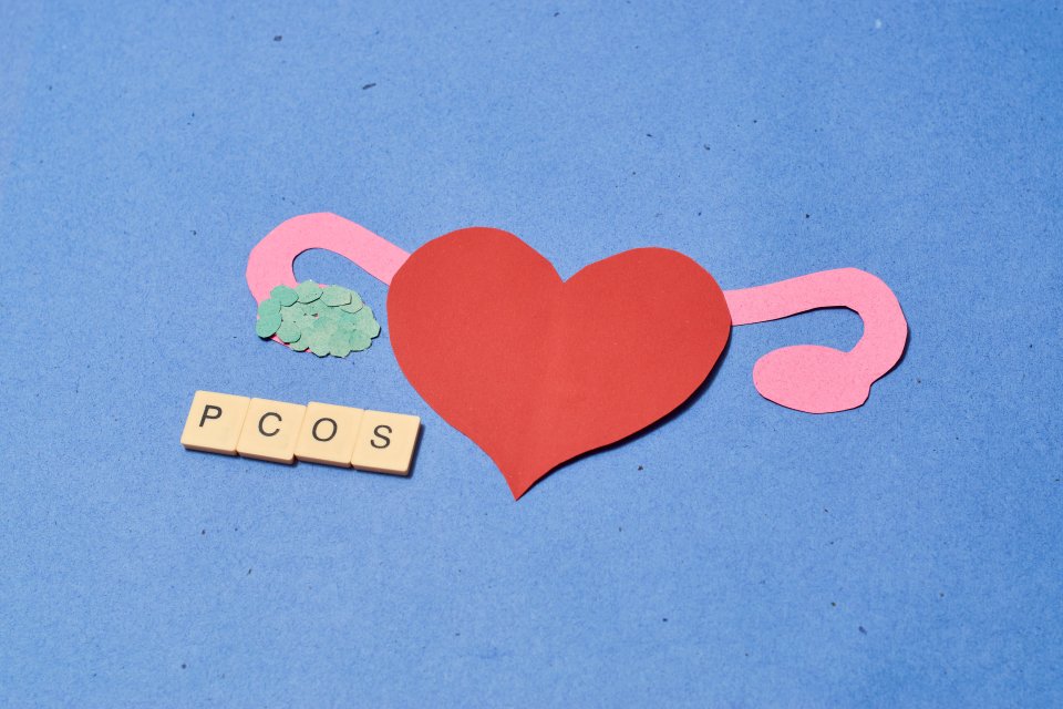 PCOS(Polistik Over Sendromu) Nedir?