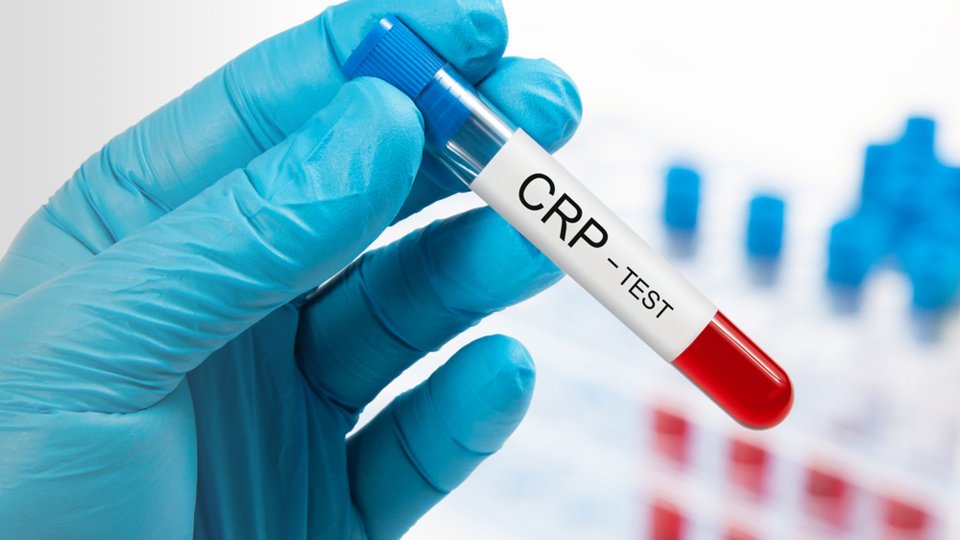 CRP (C-Reaktif Protein) Testi Nedir? 