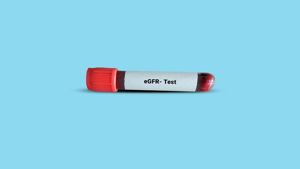 eGFR Testi Nedir? eGFR Testi Neden Yapılır?