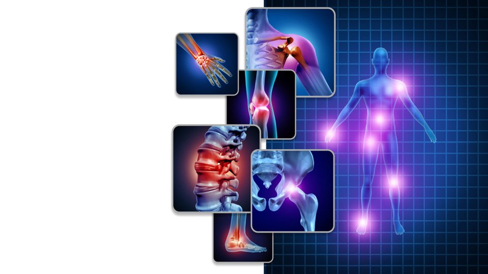 Fibromiyalji Nedir? Belirtileri Nelerdir? Nasıl Tedavi Edilir? 