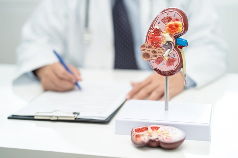 Böbrek Taşı Dökme Sırasında Rahatlatacak Yöntemler!