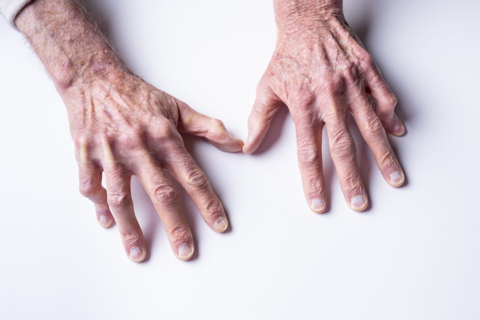 Neden Bazı İnsanların Damarları Daha Hızlı Yaşlanır? Biyolojik Yaşınızın Sırrı Damarlarınızda Saklı