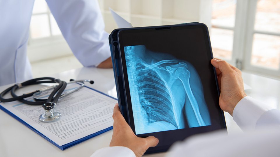 Mediastinoskopi Nedir?