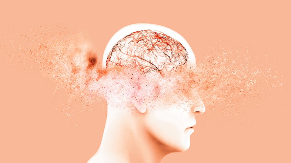 Parkinsonun 5 İlerleme Safhası