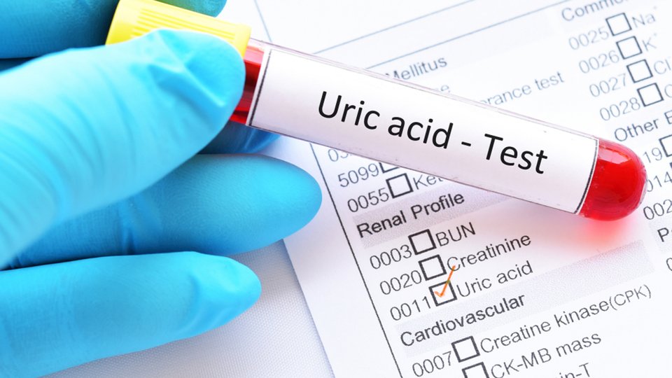 Ürik Asit Testi Nedir? Nasıl Yapılır?