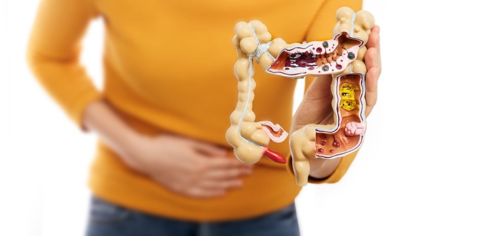 Crohn Hastalığı Nedir?