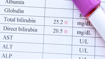Bilirubin Nedir? Ne İşe Yarar?