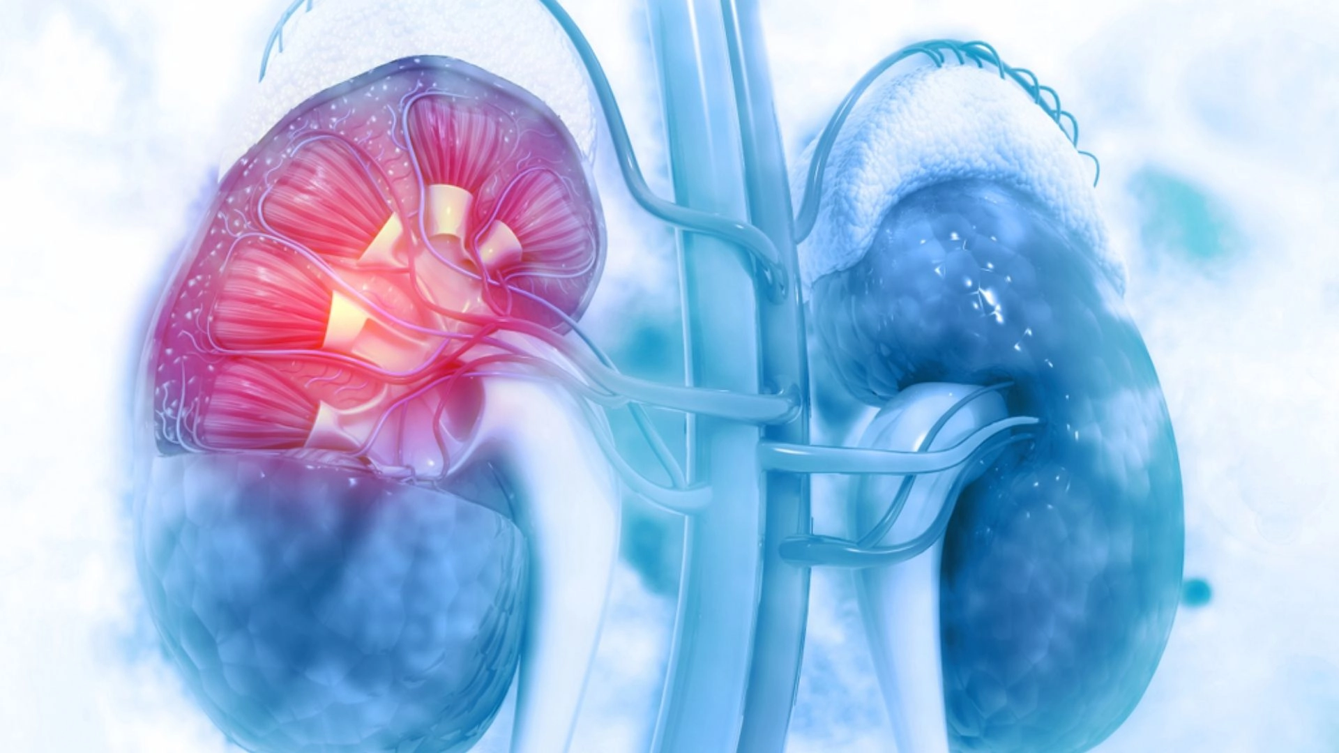 Diyabet Böbrekleri Nasıl Etkiler?