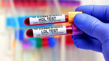 HDL Testi Nedir?
